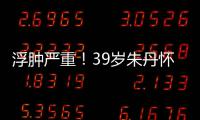  浮肿严重！39岁朱丹怀孕7个月 坚持深夜直播带货